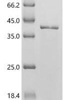 Rickettsia conorii Outer membrane protein B (ompB), partial Recombinant Protein, C-His - BioCrest Sci
