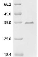 Human TATA-binding protein-associated factor 2N (TAF15), partial Recombinant Protein, N-His - BioCrest Sci