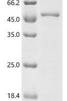 Chlamydia trachomatis Major outer membrane porin, serovar H (ompA) Recombinant Protein - BioCrest Sci