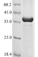 Mouse Fibroblast growth factor 5 (Fgf5) Recombinant Protein, N-10His/C-Myc - BioCrest Sci