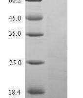Pig Parathyroid hormone (PTH) Recombinant Protein - BioCrest Sci