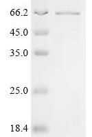 Human N(6)-adenosine-methyltransferase non-catalytic subunit METTL14 (METTL14) Recombinant Protein - BioCrest Sci
