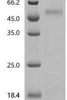 Human V-type proton ATPase subunit C 1 (ATP6V1C1) Recombinant Protein, C-10His - BioCrest Sci