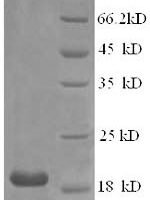 Human Interferon alpha-21 (IFNA21) Recombinant Protein - BioCrest Sci
