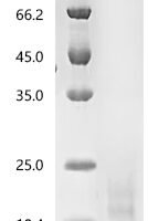 Human Myosin regulatory light chain 12A (MYL12A) Recombinant Protein, C-10His - BioCrest Sci