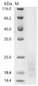 Human Myosin regulatory light chain 12A (MYL12A) Recombinant Protein, C-10His, Homo sapiens (Human), Baculovirus, C-terminal 10xHis-tagged, 21.2 kDa, purity >≥ 95% as determined by SDS-PAGE.