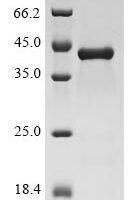 Human C-X-C motif chemokine 2 (CXCL2) Recombinant Protein - BioCrest Sci