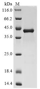 Human C-X-C motif chemokine 2 (CXCL2) Recombinant Protein, Homo sapiens (Human), E.coli, N-terminal 10xHis-GST-tagged and C-terminal Myc-tagged, 44.5 kDa, purity >≥ 85% as determined by SDS-PAGE.