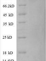 Human C-X-C motif chemokine 10 protein (CXCL10) Recombinant Protein - BioCrest Sci