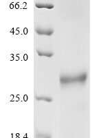 Mouse Protein FAM3B (Fam3b) Recombinant Protein - BioCrest Sci
