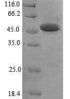 Human Parkinson disease protein 7 (PARK7), partial Recombinant Protein, N-GST - BioCrest Sci