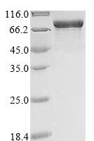 Human Myosin-6 (MYH6), partial Recombinant Protein, N-10His - BioCrest Sci