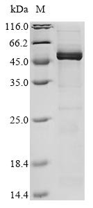 Human coronavirus 229E Nucleoprotein (N) Recombinant Protein, C-His, Human coronavirus 229E (HCoV-229E), Mammalian cell, C-terminal 6xHis-tagged, 45.7 kDa, purity >≥ 85% as determined by SDS-PAGE.