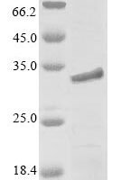 Mouse Myocilin (Myoc), partial Recombinant Protein - BioCrest Sci