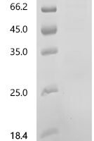 Human Protein Wnt-8a (WNT8A) Recombinant Protein, C-10His-HSA - BioCrest Sci