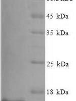Mouse Serum amyloid A-3 protein (Saa3), partial Recombinant Protein, N-His, aa 20–122, E.coli - BioCrest Sci