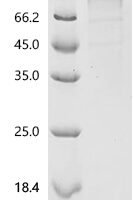 Macaca fascicularis Heat shock protein HSP 90-beta (HSP90AB1) Recombinant Protein, C-10His, aa 1–724, Baculovirus - BioCrest Sci