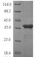 Human Small ubiquitin-related modifier 4 (SUMO4) Recombinant Protein - BioCrest Sci