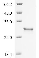 Macrovipera lebetina obtusa Disintegrin obtustatin Recombinant Protein - BioCrest Sci