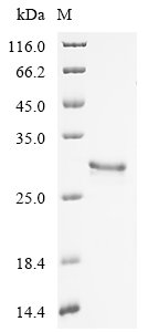 Macrovipera lebetina obtusa Disintegrin obtustatin Recombinant Protein, Macrovipera lebetina obtusa (Levant blunt-nosed viper) (Vipera lebetina obtusa), E.coli, N-terminal GST-tagged, 31.1 kDa, purity >≥ 90% as determined by SDS-PAGE.