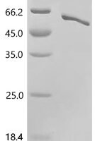 Chicken Ovalbumin (SERPINB14) Recombinant Protein, N-His-SUMOstar - BioCrest Sci
