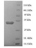Human N-alpha-acetyltransferase 38, NatC auxiliary subunit (NAA38) Recombinant Protein - BioCrest Sci
