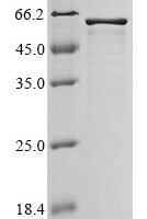 Agrobacterium fabrum T-DNA border endonuclease virD2 (virD2) Recombinant Protein - BioCrest Sci