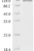 Mouse Protein Wnt-5a (Wnt5a) Recombinant Protein, C-10His-HSA - BioCrest Sci