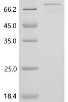 Human Vascular endothelial zinc finger 1 (VEZF1) Recombinant Protein, C-His, aa 1–521, E.coli - BioCrest Sci
