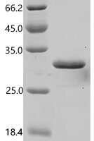 Mouse Oncostatin-M (Osm) Recombinant Protein, N-His, aa 25–206, E.coli - BioCrest Sci