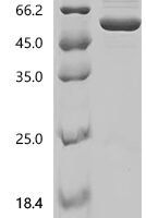 Mouse Tumor necrosis factor receptor superfamily member 16 (Ngfr), partial, Biotinylated Recombinant Protein, N-MBP/C-His-Avi - BioCrest Sci