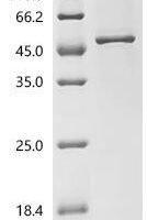 Human Glycogen synthase kinase-3 beta (GSK3B)(Y134P) Recombinant Protein - BioCrest Sci