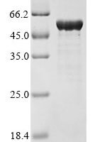Pseudomonas stutzeri Nitrite reductase (nirS), partial Recombinant Protein - BioCrest Sci