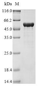Pseudomonas stutzeri Nitrite reductase (nirS), partial Recombinant Protein, Pseudomonas stutzeri (Pseudomonas perfectomarina), E.coli, N-terminal 10xHis-tagged and C-terminal Myc-tagged, 56.0 kDa, purity >≥ 85% as determined by SDS-PAGE.
