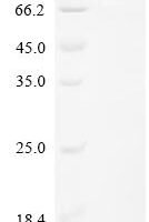 Human E3 ubiquitin-protein ligase DTX3L (DTX3L) Recombinant Protein - BioCrest Sci