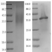 Human Legumain (LGMN) Recombinant Protein - BioCrest Sci