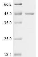 Human SPARC-related modular calcium-binding protein 1(SMOC1), partial Recombinant Protein - BioCrest Sci