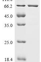 Human GTPase NRas (NRAS) (Q61R), partial, Biotinylated Recombinant Protein - BioCrest Sci