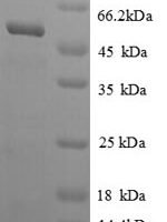 Saccharomyces cerevisiae Adenosylhomocysteinase (SAH1), partial Recombinant Protein - BioCrest Sci
