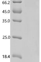 Human Tolloid-like protein 2 (TLL2) Recombinant Protein - BioCrest Sci