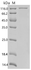 Human Tolloid-like protein 2 (TLL2) Recombinant Protein, Homo sapiens (Human), E.coli, C-terminal 6xHis-tagged, 104.6 kDa, purity >≥ 85% as determined by SDS-PAGE.