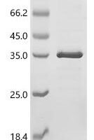 Human Netrin receptor UNC5C (UNC5C), partial Recombinant Protein - BioCrest Sci
