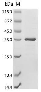 Human Netrin receptor UNC5C (UNC5C), partial Recombinant Protein, Homo sapiens (Human), E.coli, C-terminal 6xHis-tagged, 31.5 kDa, purity >≥ 85% as determined by SDS-PAGE.