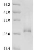 Pig Interleukin-2 receptor subunit alpha (IL2RA), partial Recombinant Protein, C-His, aa 22–245, Yeast - BioCrest Sci
