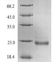 Human von Willebrand factor A domain-containing protein 5B2 (VWA5B2), partial Recombinant Protein - BioCrest Sci