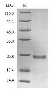 Human von Willebrand factor A domain-containing protein 5B2 (VWA5B2), partial Recombinant Protein, Homo sapiens (Human), E.coli, N-terminal 6xHis-SUMO-tagged, 24.6 kDa, purity >≥ 90% as determined by SDS-PAGE.