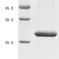 Human Cytokine receptor common subunit gamma (IL2RG) (N75Q), partial Recombinant Protein, N-His - BioCrest Sci