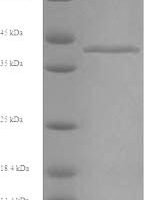 Rabbit Fructose-bisphosphate aldolase B (ALDOB) Recombinant Protein, N-His - BioCrest Sci