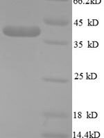 Human TeRatocarcinoma-derived growth factor 1 (TDGF1), partial Recombinant Protein, N-GST - BioCrest Sci