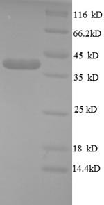 Human TeRatocarcinoma-derived growth factor 1 (TDGF1), partial Recombinant Protein, N-GST, Homo sapiens (Human), E.coli, N-terminal GST-tagged, 40.5 kDa, purity >≥ 90% as determined by SDS-PAGE.